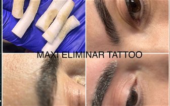 Magnetic Remove Tattoo